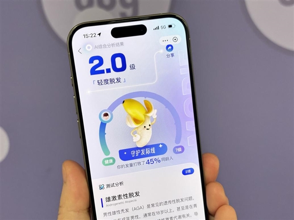 支付宝推出 AI 毛发自测工具：上传照片可测脱发程度